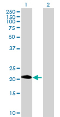 Lane 1: PAGE4 transfected lysate (11.33 KDa) Lane 2: Non-transfected lysate.