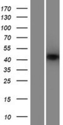 Western Blot: SARP Overexpression Lysate (Adult Normal) [NBP2-04805] Left-Empty vector transfected control cell lysate (HEK293 cell lysate); Right -Over-expression Lysate for SARP.