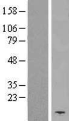 Western Blot: MOBP Overexpression Lysate (Adult Normal) [NBP2-04798] Left-Empty vector transfected control cell lysate (HEK293 cell lysate); Right -Over-expression Lysate for MOBP.