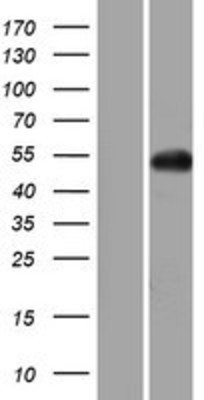 Western Blot: GNAL Overexpression Lysate (Adult Normal) [NBP2-04792] Left-Empty vector transfected control cell lysate (HEK293 cell lysate); Right -Over-expression Lysate for GNAL.