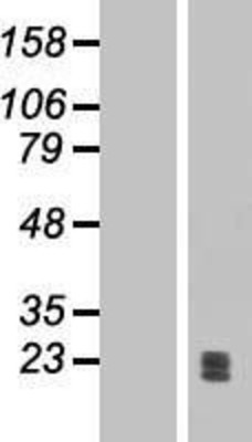Western Blot: Ephrin A1 Overexpression Lysate (Adult Normal) [NBP2-04832] Left-Empty vector transfected control cell lysate (HEK293 cell lysate); Right -Over-expression Lysate for Ephrin A1.