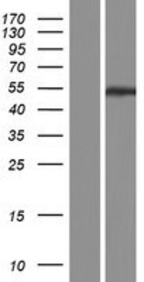 Western Blot: PPP2R2C Overexpression Lysate (Adult Normal) [NBP2-04872] Left-Empty vector transfected control cell lysate (HEK293 cell lysate); Right -Over-expression Lysate for PPP2R2C.
