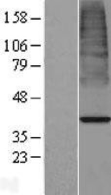 Western Blot: ACOT7 Overexpression Lysate (Adult Normal) [NBP2-04869] Left-Empty vector transfected control cell lysate (HEK293 cell lysate); Right -Over-expression Lysate for ACOT7.