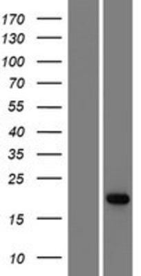 Western Blot: ADAT2 Overexpression Lysate (Adult Normal) [NBP2-04860] Left-Empty vector transfected control cell lysate (HEK293 cell lysate); Right -Over-expression Lysate for ADAT2.