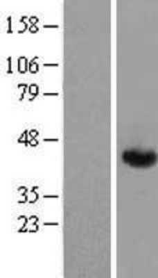 Western Blot: Aldolase A Overexpression Lysate (Adult Normal) [NBP2-04772] Left-Empty vector transfected control cell lysate (HEK293 cell lysate); Right -Over-expression Lysate for Aldolase A.