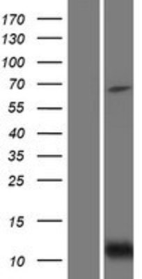 Western Blot: Bid Overexpression Lysate (Adult Normal) [NBP2-04747] Left-Empty vector transfected control cell lysate (HEK293 cell lysate); Right -Over-expression Lysate for Bid.