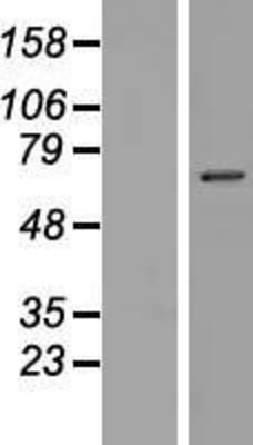 Western Blot: NKPD1 Overexpression Lysate (Adult Normal) [NBP2-04695] Left-Empty vector transfected control cell lysate (HEK293 cell lysate); Right -Over-expression Lysate for NKPD1.