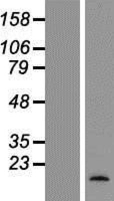 Western Blot: Osteocalcin Overexpression Lysate (Adult Normal) [NBP2-04647] Left-Empty vector transfected control cell lysate (HEK293 cell lysate); Right -Over-expression Lysate for Osteocalcin.