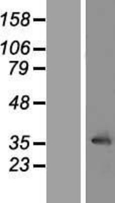 Western Blot: LRRC10 Overexpression Lysate (Adult Normal) [NBP2-04593] Left-Empty vector transfected control cell lysate (HEK293 cell lysate); Right -Over-expression Lysate for LRRC10.