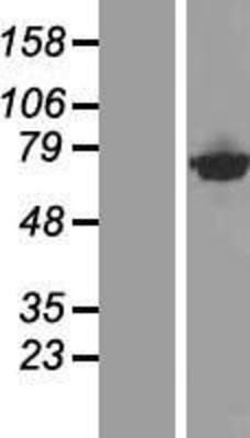 Western Blot: CTPS2 Overexpression Lysate (Adult Normal) [NBP2-09705] Left-Empty vector transfected control cell lysate (HEK293 cell lysate); Right -Over-expression Lysate for CTPS2.