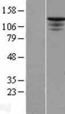 Western Blot: ST5 Overexpression Lysate (Adult Normal) [NBP2-09816] Left-Empty vector transfected control cell lysate (HEK293 cell lysate); Right -Over-expression Lysate for ST5.