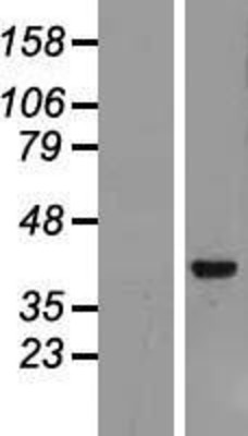 Western Blot: Archaemetzincin 2 Overexpression Lysate (Adult Normal) [NBP2-11595] Left-Empty vector transfected control cell lysate (HEK293 cell lysate); Right -Over-expression Lysate for Archaemetzincin 2.