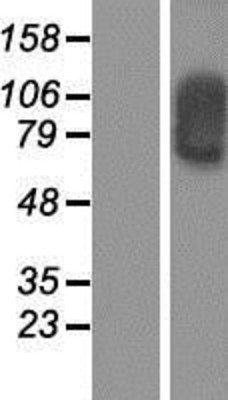 Western Blot: SOX30 Overexpression Lysate (Adult Normal) [NBP2-04971] Left-Empty vector transfected control cell lysate (HEK293 cell lysate); Right -Over-expression Lysate for SOX30.