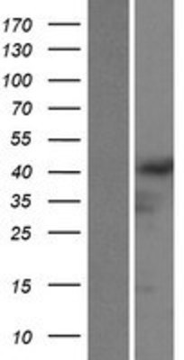 Western Blot: GRASP1 Overexpression Lysate (Adult Normal) [NBP2-04899] Left-Empty vector transfected control cell lysate (HEK293 cell lysate); Right -Over-expression Lysate for GRASP1.