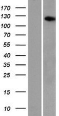 Western Blot: AASDH Overexpression Lysate (Adult Normal) [NBP2-04884] Left-Empty vector transfected control cell lysate (HEK293 cell lysate); Right -Over-expression Lysate for AASDH.