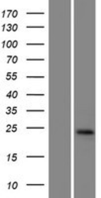 Western Blot: GGTLC1 Overexpression Lysate (Adult Normal) [NBP2-04983] Left-Empty vector transfected control cell lysate (HEK293 cell lysate); Right -Over-expression Lysate for GGTLC1.