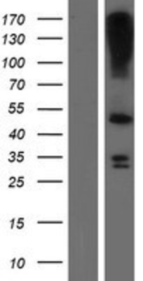 Western Blot: LASS3 Overexpression Lysate (Adult Normal) [NBP2-04946] Left-Empty vector transfected control cell lysate (HEK293 cell lysate); Right -Over-expression Lysate for LASS3.