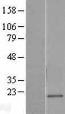 Western Blot: CD300E Overexpression Lysate (Adult Normal) [NBP2-04925] Left-Empty vector transfected control cell lysate (HEK293 cell lysate); Right -Over-expression Lysate for CD300E.