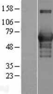 Western Blot: CaMKK Overexpression Lysate (Adult Normal) [NBP2-05167] Left-Empty vector transfected control cell lysate (HEK293 cell lysate); Right -Over-expression Lysate for CaMKK.