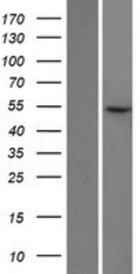 Western Blot: LIN9 Overexpression Lysate (Adult Normal) [NBP2-05151] Left-Empty vector transfected control cell lysate (HEK293 cell lysate); Right -Over-expression Lysate for LIN9.
