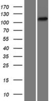 Western Blot: PYK2 Overexpression Lysate (Adult Normal) [NBP2-05141] Left-Empty vector transfected control cell lysate (HEK293 cell lysate); Right -Over-expression Lysate for PYK2.