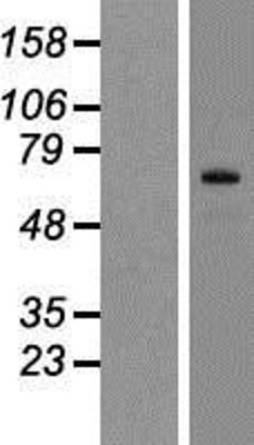 Western Blot: Six5 Overexpression Lysate (Adult Normal) [NBP2-05043] Left-Empty vector transfected control cell lysate (HEK293 cell lysate); Right -Over-expression Lysate for Six5.
