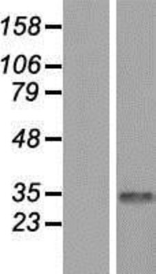 Western Blot: CDYL Overexpression Lysate (Adult Normal) [NBP2-05204] Left-Empty vector transfected control cell lysate (HEK293 cell lysate); Right -Over-expression Lysate for CDYL.