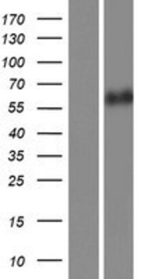 Western Blot: CaMKII beta Overexpression Lysate (Adult Normal) [NBP2-05192] Left-Empty vector transfected control cell lysate (HEK293 cell lysate); Right -Over-expression Lysate for CaMKII beta.