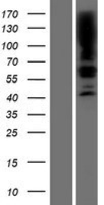 Western Blot: SGPL1 Overexpression Lysate (Adult Normal) [NBP2-07936] Left-Empty vector transfected control cell lysate (HEK293 cell lysate); Right -Over-expression Lysate for SGPL1.