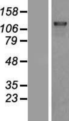 Western Blot: DHX8 Overexpression Lysate (Adult Normal) [NBP2-07809] Left-Empty vector transfected control cell lysate (HEK293 cell lysate); Right -Over-expression Lysate for DHX8.