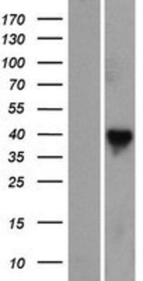 Western Blot: RASSF7 Overexpression Lysate (Adult Normal) [NBP2-08005] Left-Empty vector transfected control cell lysate (HEK293 cell lysate); Right -Over-expression Lysate for RASSF7.