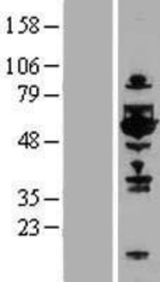 Western Blot: TOM1L1 Overexpression Lysate (Adult Normal) [NBP2-07742] Left-Empty vector transfected control cell lysate (HEK293 cell lysate); Right -Over-expression Lysate for TOM1L1.