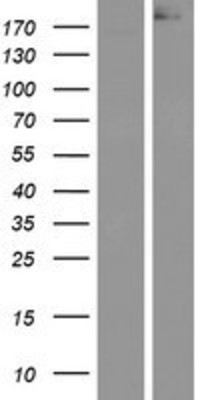 Western Blot: APC Overexpression Lysate (Adult Normal) [NBP2-09451] Left-Empty vector transfected control cell lysate (HEK293 cell lysate); Right -Over-expression Lysate for APC.