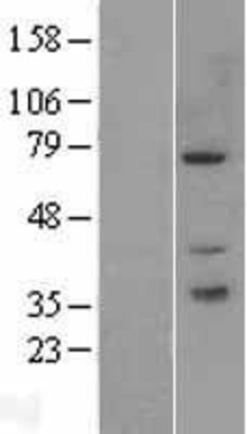 Western Blot: PAK6 Overexpression Lysate (Adult Normal) [NBP2-09483] Left-Empty vector transfected control cell lysate (HEK293 cell lysate); Right -Over-expression Lysate for PAK6.
