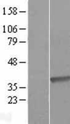 Western Blot: DHRS9 Overexpression Lysate (Adult Normal) [NBP2-09625] Left-Empty vector transfected control cell lysate (HEK293 cell lysate); Right -Over-expression Lysate for DHRS9.