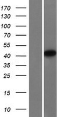 Western Blot: NDRG4 Overexpression Lysate (Adult Normal) [NBP2-09514] Left-Empty vector transfected control cell lysate (HEK293 cell lysate); Right -Over-expression Lysate for NDRG4.