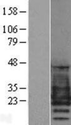 Western Blot: PMP22 Overexpression Lysate (Adult Normal) [NBP2-10006] Left-Empty vector transfected control cell lysate (HEK293 cell lysate); Right -Over-expression Lysate for PMP22.