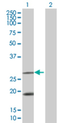 Lane 1: FXN transfected lysate (23.1 KDa). Lane 2: Non-transfected lysate.