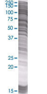 IL17RC transfected lysate.