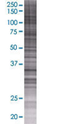 UPP2 transfected lysate.