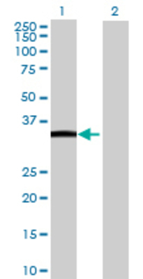 Lane 1: UPP2 transfected lysate (34.98 KDa) Lane 2: Non-transfected lysate.