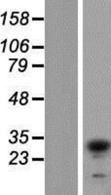 Western Blot: TIP30 Overexpression Lysate (Adult Normal) [NBP2-10921] Left-Empty vector transfected control cell lysate (HEK293 cell lysate); Right -Over-expression Lysate for TIP30.