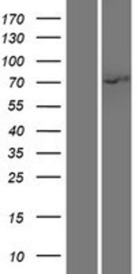Western Blot: IRAK Overexpression Lysate (Adult Normal) [NBP2-11046] Left-Empty vector transfected control cell lysate (HEK293 cell lysate); Right -Over-expression Lysate for IRAK.