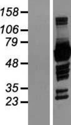 Western Blot: NOXA2 Overexpression Lysate (Adult Normal) [NBP2-11127] Left-Empty vector transfected control cell lysate (HEK293 cell lysate); Right -Over-expression Lysate for NOXA2.
