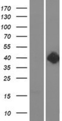 Western Blot: Dopamine D2 Receptor Overexpression Lysate (Adult Normal) [NBP2-11287] Left-Empty vector transfected control cell lysate (HEK293 cell lysate); Right -Over-expression Lysate for Dopamine D2 Receptor.
