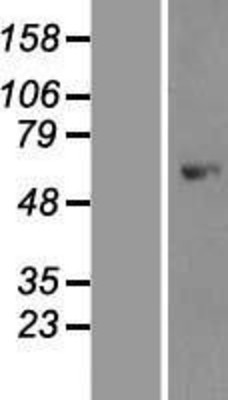 Western Blot: AMPK alpha 1 Overexpression Lysate (Adult Normal) [NBP2-10421] Left-Empty vector transfected control cell lysate (HEK293 cell lysate); Right -Over-expression Lysate for AMPK alpha 1.