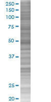 ZNF323 transfected lysate.