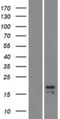 Western Blot: Luteinizing Hormone beta Overexpression Lysate (Adult Normal) [NBP2-10716] Left-Empty vector transfected control cell lysate (HEK293 cell lysate); Right -Over-expression Lysate for Luteinizing Hormone beta.