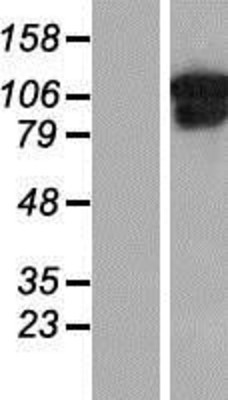 Western Blot: Collagen VI Overexpression Lysate (Adult Normal) [NBP2-10777] Left-Empty vector transfected control cell lysate (HEK293 cell lysate); Right -Over-expression Lysate for Collagen VI.