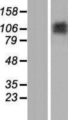 Western Blot: Matrilin 2 Overexpression Lysate (Adult Normal) [NBP2-10822] Left-Empty vector transfected control cell lysate (HEK293 cell lysate); Right -Over-expression Lysate for Matrilin 2.